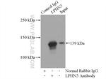 LPHN3 Antibody in Immunoprecipitation (IP)