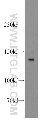 LPHN3 Antibody in Western Blot (WB)