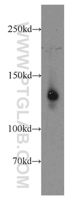 LPHN3 Antibody in Western Blot (WB)