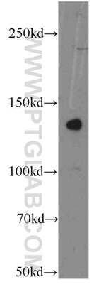 LPHN3 Antibody in Western Blot (WB)