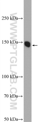 LPHN3 Antibody in Western Blot (WB)