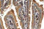 GPR124 Antibody in Immunohistochemistry (Paraffin) (IHC (P))