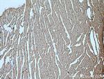 TNS1 Antibody in Immunohistochemistry (Paraffin) (IHC (P))