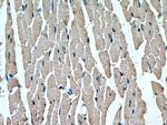 TNS1 Antibody in Immunohistochemistry (Paraffin) (IHC (P))