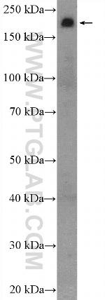 TNS1 Antibody in Western Blot (WB)