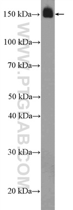 TNS1 Antibody in Western Blot (WB)