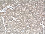 TNS1 Antibody in Immunohistochemistry (Paraffin) (IHC (P))