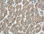 TNS1 Antibody in Immunohistochemistry (Paraffin) (IHC (P))
