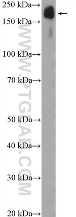 TNS1 Antibody in Western Blot (WB)