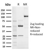 Elastin (ELN) Antibody in SDS-PAGE (SDS-PAGE)