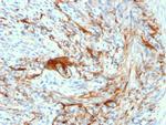 Elastin (ELN) Recombinant Rabbit Monoclonal Antibody (ELN, 3131R)