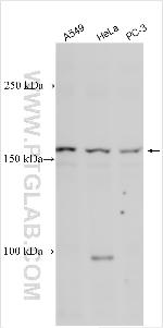 ZNF608 Antibody in Western Blot (WB)