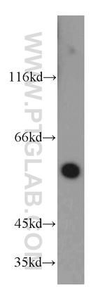 NOX3 Antibody in Western Blot (WB)