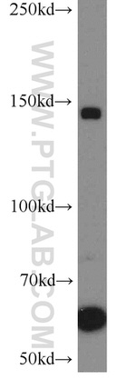 PCDH11Y Antibody in Western Blot (WB)