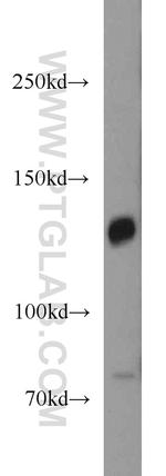 PCDH11X Antibody in Western Blot (WB)