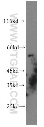 GPR101 Antibody in Western Blot (WB)