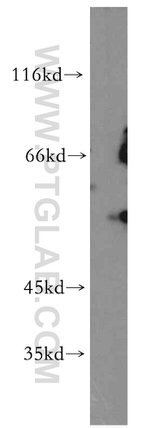 GPR101 Antibody in Western Blot (WB)