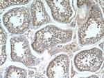 GPR123 Antibody in Immunohistochemistry (Paraffin) (IHC (P))