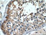 GPR123 Antibody in Immunohistochemistry (Paraffin) (IHC (P))