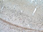 GPR139 Antibody in Immunohistochemistry (Paraffin) (IHC (P))