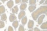 GAB4 Antibody in Immunohistochemistry (Paraffin) (IHC (P))