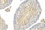 GAB4 Antibody in Immunohistochemistry (Paraffin) (IHC (P))