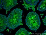 GAB4 Antibody in Immunohistochemistry (PFA fixed) (IHC (PFA))