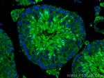 GAB4 Antibody in Immunohistochemistry (PFA fixed) (IHC (PFA))