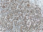 GAB3 Antibody in Immunohistochemistry (Paraffin) (IHC (P))