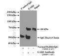 GAB3 Antibody in Immunoprecipitation (IP)