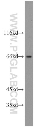 GAB3 Antibody in Western Blot (WB)
