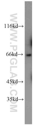 GAB3 Antibody in Western Blot (WB)