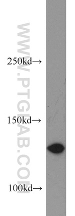 DGKK Antibody in Western Blot (WB)