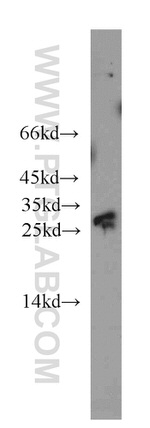 RIMS4 Antibody in Western Blot (WB)