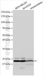 NBPF4 Antibody in Western Blot (WB)