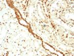 Emerin Monoclonal Antibody (EMD, 2168)