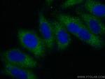 RIPK5 Antibody in Immunocytochemistry (ICC/IF)