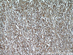 CD45 Antibody in Immunohistochemistry (Paraffin) (IHC (P))