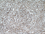 CD45 Antibody in Immunohistochemistry (Paraffin) (IHC (P))