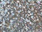 CD45 Antibody in Immunohistochemistry (Paraffin) (IHC (P))