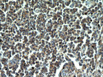 CD45 Antibody in Immunohistochemistry (Paraffin) (IHC (P))