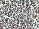 CD45 Antibody in Immunohistochemistry (Paraffin) (IHC (P))