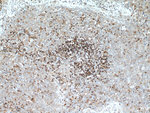 CD45 Antibody in Immunohistochemistry (Paraffin) (IHC (P))
