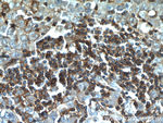 CD45 Antibody in Immunohistochemistry (Paraffin) (IHC (P))
