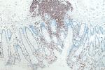 CD45 Antibody in Immunohistochemistry (Paraffin) (IHC (P))