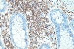 CD45 Antibody in Immunohistochemistry (Paraffin) (IHC (P))