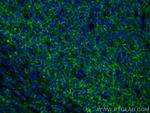 CD45 Antibody in Immunohistochemistry (PFA fixed) (IHC (PFA))