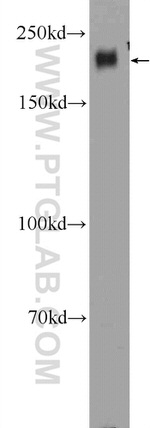 CD45 Antibody in Western Blot (WB)
