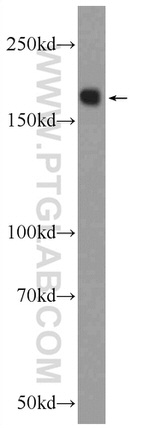 CD45 Antibody in Western Blot (WB)
