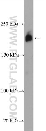 CD45 Antibody in Western Blot (WB)